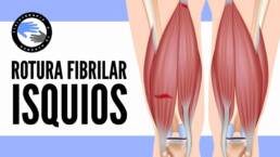 Rotura fibrilar de los isquiotibiales, que es, por que se produce, diagnostico y tratamiento