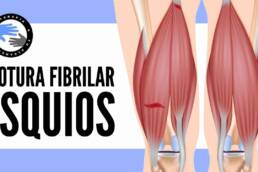 Rotura fibrilar de los isquiotibiales, que es, por que se produce, diagnostico y tratamiento