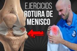 Rutina de EJECICIOS para ROTURA DE MENISCO – FASE 1