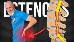 Rutina de EJERCICIOS para la ESTENOSIS LUMBAR
