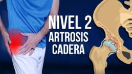 Rutina de ejercicios para la ARTROSIS de cadera en 20 minutos – NIVEL 2