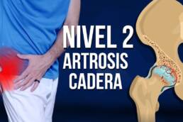 Rutina de ejercicios para la ARTROSIS de cadera en 20 minutos – NIVEL 2