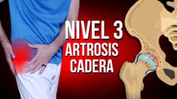 Rutina de ejercicios para la ARTROSIS de cadera en 20 minutos – NIVEL 3