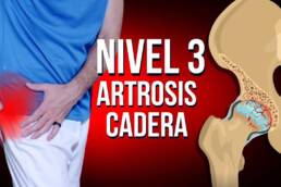 Rutina de ejercicios para la ARTROSIS de cadera en 20 minutos – NIVEL 3