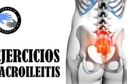 Sacroileitis o falsa ciatica, ejercicios para aliviar el dolor de la espalda baja o lumbalgia