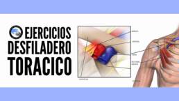 Sindrome del desfiladero toracico, ejercicios para aliviar los sintomas