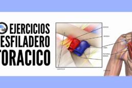 Sindrome del desfiladero toracico, ejercicios para aliviar los sintomas