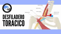 Sindrome del desfiladero toracico, que es, por que se produce, diagnostico y tratamiento
