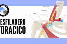 Sindrome del desfiladero toracico, que es, por que se produce, diagnostico y tratamiento