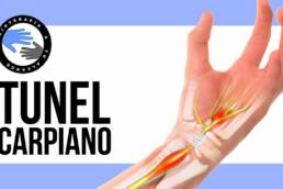 Sindrome del tunel del carpo, que es, porque se produce, sintomas y tratamiento