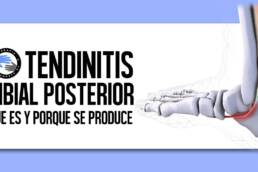 Tendinitis del tibial posterior, que es y por que se produce