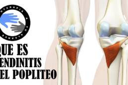 Tendinitis poplitea, que es y porque se produce el dolor detras de la rodilla