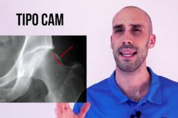 Test de fadir, como detectar el choque femoroacetabular
