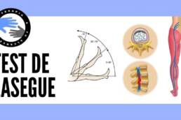 Test de lasegue, como saber si la ciatica esta causada por una hernia discal