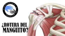 Tendinitis, estiramientos para aliviar el dolor de hombro