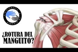 Tendinitis, estiramientos para aliviar el dolor de hombro