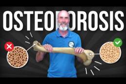 Anatomia y huesos de la mano, fracturas mas frecuentes