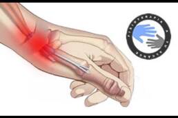 Tendinitis de muñeca o Quervain, estiramientos para aliviar el dolor
