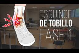 Esguince de tobillo, ejercicios y rehabilitacion fase 1