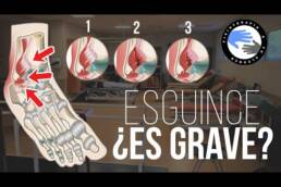Masaje para esguince de tobillo