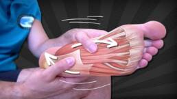 Neuroma de Morton, que es y como se produce