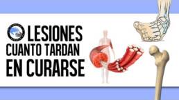 Estiramiento y anatomia del triceps