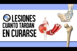 Estiramiento y anatomia del triceps