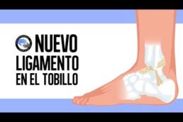 Esguince de tobillo, ejercicios y rehabilitacion fase 3