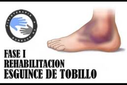 Masaje para esguince de tobillo, como autotratar tu lesion