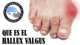 Masaje y ejercicios para juanetes o hallux valgus