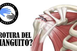 ¿Dolor de hombro? 3 test para saber si tu manguito rotador tiene una lesion o esta roto