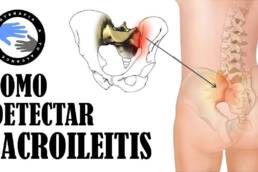 ¿Dolor lumbar? 3 test para saber si tu sacroiliaca te esta causando una sacroileitis