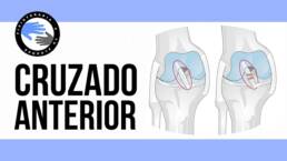 ¿Ligamento cruzado anterior roto? 2 test para evaluarlo