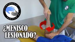 ¿Rotura de menisco? 2 test para saber si tu menisco esta lesionado